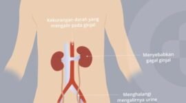 Meski berpotensi fatal, gagal ginjal akut tidak selalu permanen